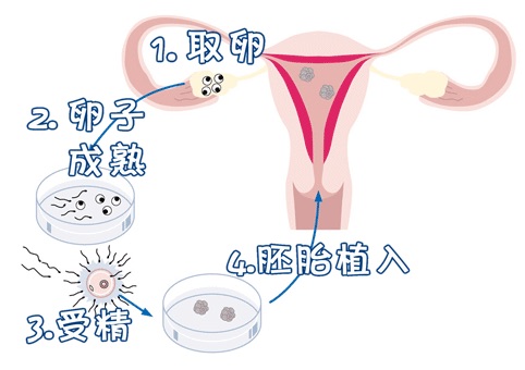 生殖中心